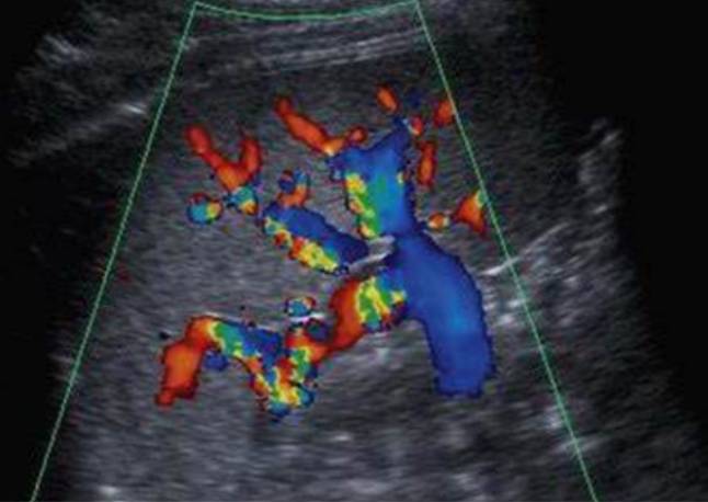 Ultrasound Evaluation of the Pancreas